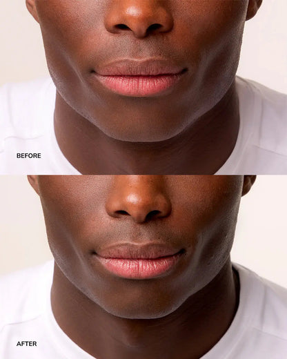 NORDH Lip Treatment - The Intensive Repair NORDH