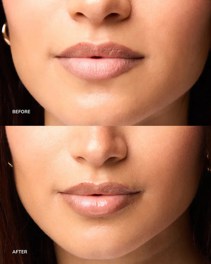 NORDH Lip Treatment - The Intensive Repair NORDH