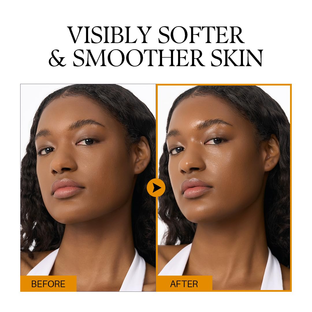 Before and after comparison of a woman's skin with text 'Visibly Softer & Smoother Skin'.