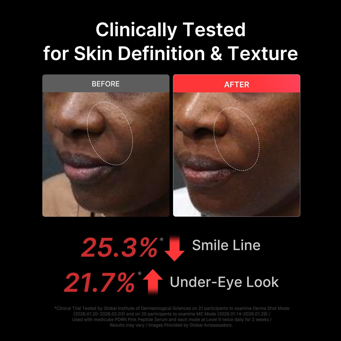 Medicube AGE-R Booster Pro X2 skin firming microcurrent mode, Beauty Edit Mayfair London